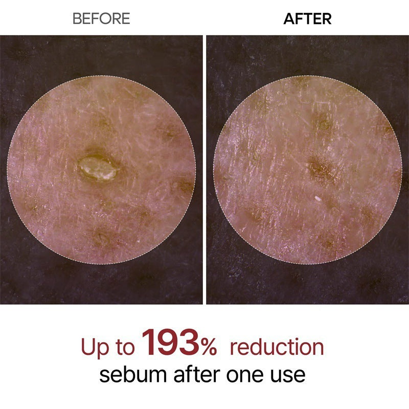 LumiRice™ Peel Shot