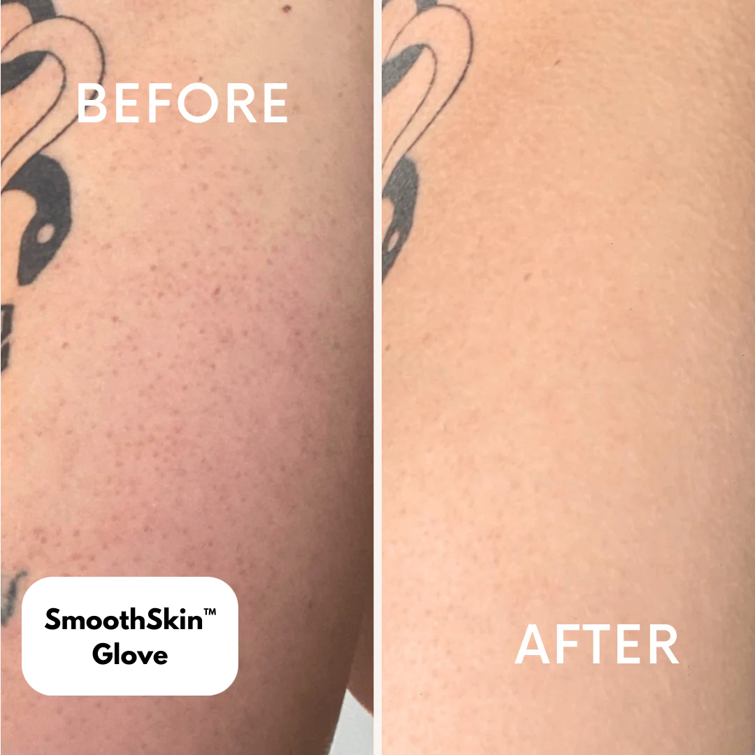 SmoothSkin™ Glove