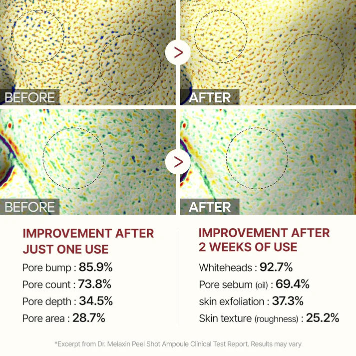 LumiRice™ Peel Shot