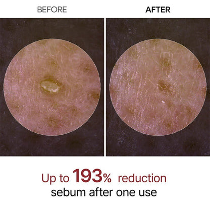 LumiRice™ Peel Shot